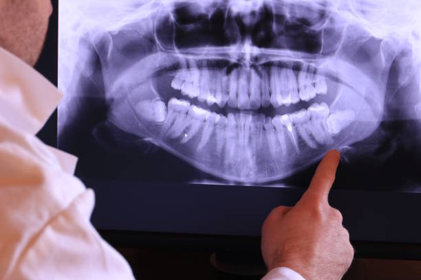 Best Emergency Dental Care for Broken or Chipped Teeth in Derby, CT