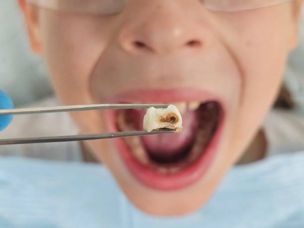 Best Pediatric Emergency Dentist in Derby, CT